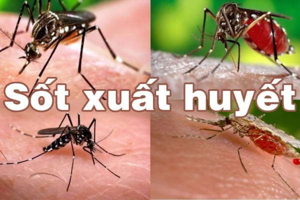 Sốt xuất huyết – Căn bệnh lây nhiễm dễ dàng bùng phát