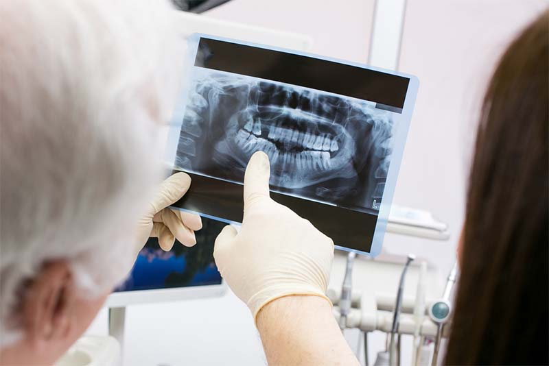 Bước 1: Kiểm tra tình trạng răng và tư vấn